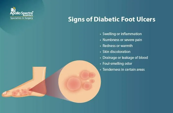 Foot Ulcer (Diabetic)