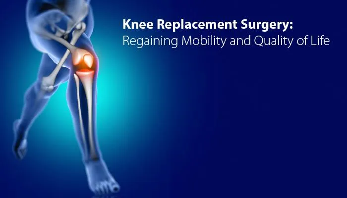 Knee Replacement Surgery: Regaining Mobility and Quality of Life