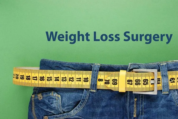 Bariatric Surgery for Weight Loss