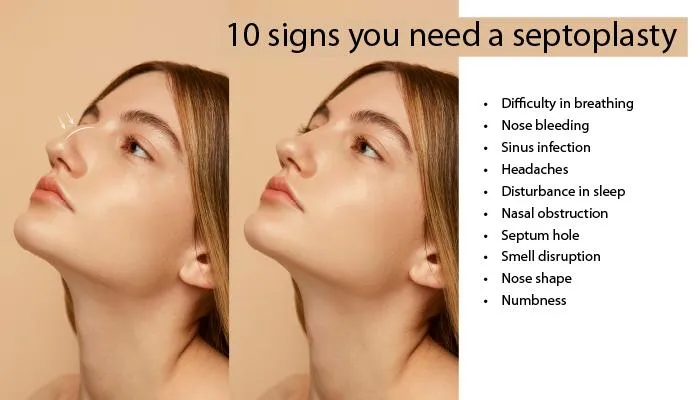 10 signs you need a septoplasty