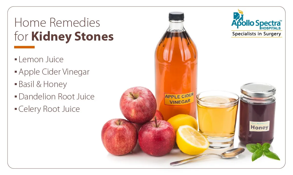 Top 10 Home Remedies for Kidney Stones