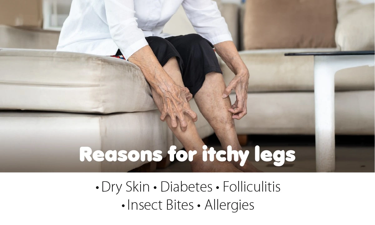 Reasons for Itchy Legs