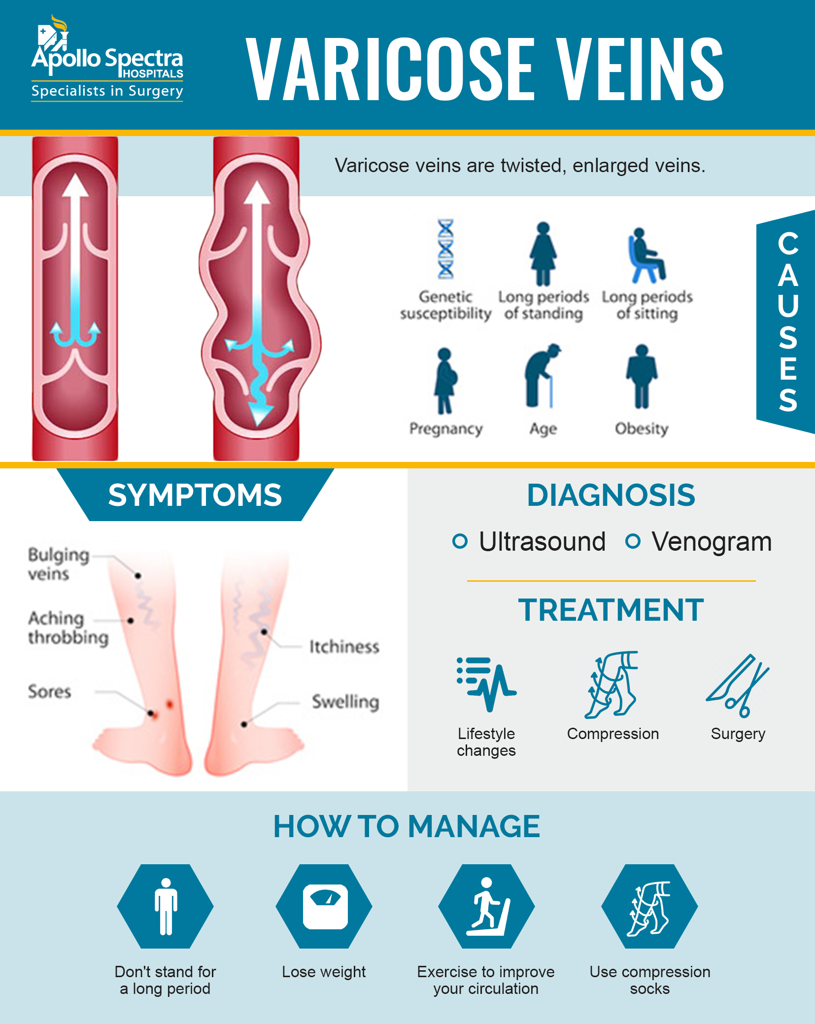 Getting Rid of Varicose Veins: Treatment and Prevention – The