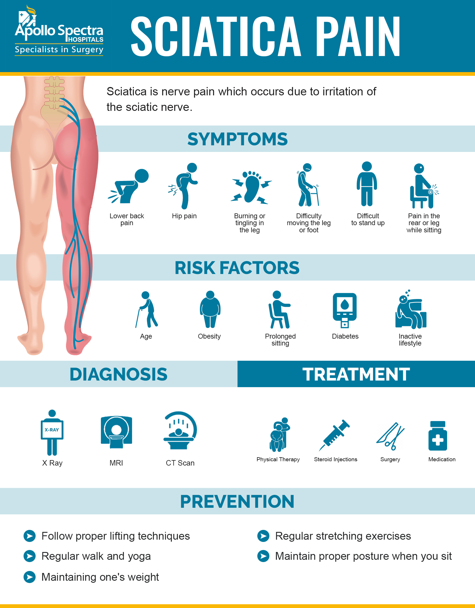 Sciatica Symptoms, Diagnosis & Treatment